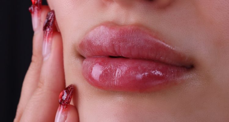 What Is A Lip Flip Unveiling The Popular Cosmetic Procedure