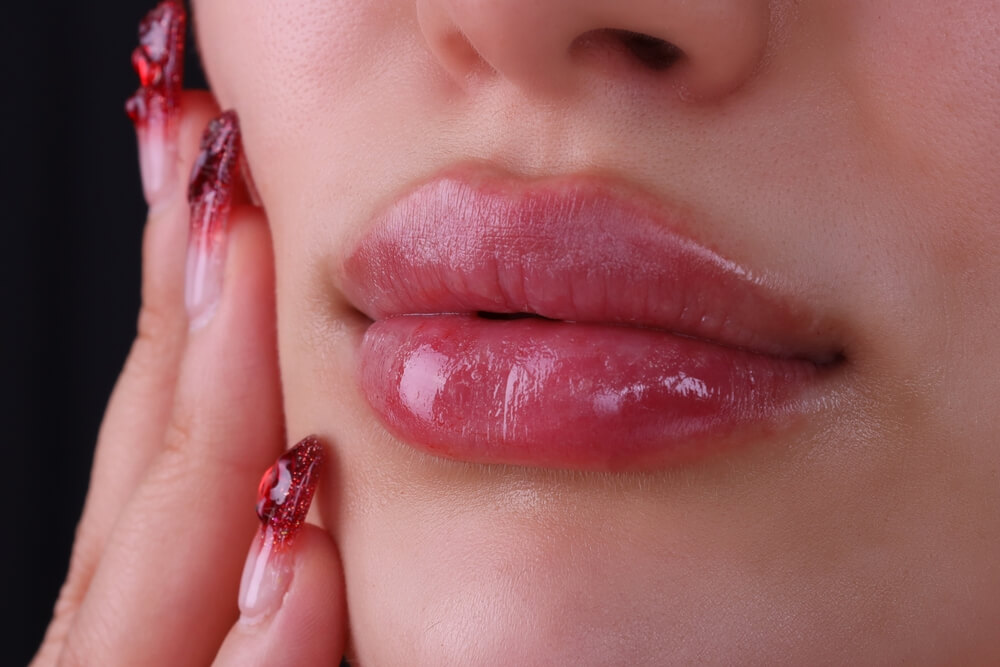 What Is A Lip Flip Unveiling The Popular Cosmetic Procedure